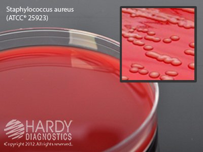 10/BOX, Prepared Media Tryptic Soy Agar (TSA) with 5% Sheep Blood Red Petri Plate Format