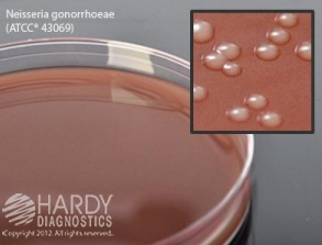 Chocolate Agar, (Gc Agar Base With 1% Bovine Hemoglobin Andkoenzyme Supplements), For Fastidious Bacteria, 15 x 100 mmplate Plates